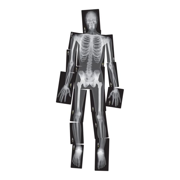 Life-Size Human X-Rays